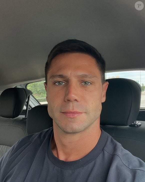 Jonas Sulzbach ficou muito diferente com os novos procedimentos estéticos em seu rosto