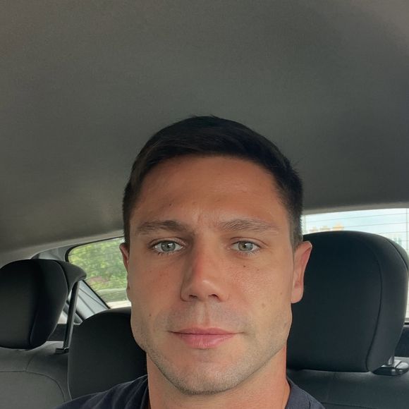 Jonas Sulzbach ficou muito diferente com os novos procedimentos estéticos em seu rosto