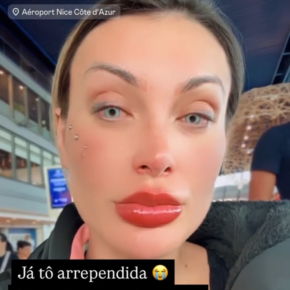 Andressa Urach diz que se arrependeu de ter feito cirurgia para mudar a cor dos olhos após sentir fortes dores