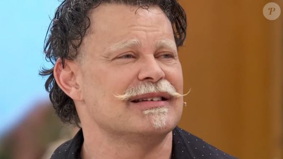 Carmo Dalla Vecchia causou na web ao surgir até com o dente quebrado no 'Encontro'