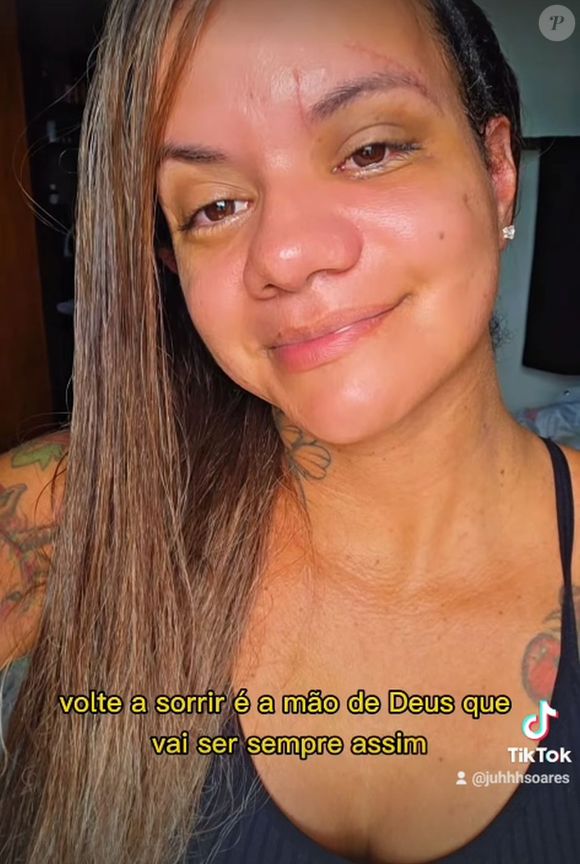 Juliana Soares precisou reconstruir a face após levar 61 socos