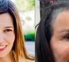 Gretchen sofre com a queda de cabelo