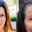Nem gominha, nem shampoo bomba! Ana Molina, dermatologista: 'O azeite de oliva ajuda a melhorar o crescimento do cabelo e combate a queda'