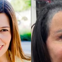 Nem gominha, nem shampoo bomba! Ana Molina, dermatologista: 'O azeite de oliva ajuda a melhorar o crescimento do cabelo e combate a queda'