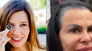 Nem gominha, nem shampoo bomba! Ana Molina, dermatologista: 'O azeite de oliva ajuda a melhorar o crescimento do cabelo e combate a queda'