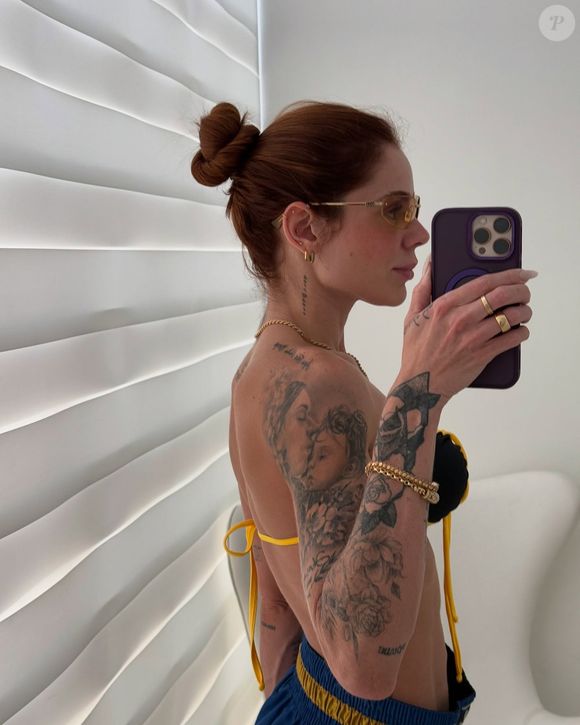 Thaís Vasconcellos revelou que teve que aplicar uma injeção na coxa por não ter gordura na barriga