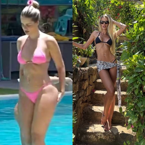 Antes e depois de Yasmin Brunet: modelo perdeu quase 20 kg após o tratamento do lipedema com dieta e exercícios
