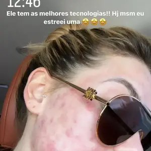 Virgínia Fonseca faz tratamento para a pele (24 de novembro): A influencer foi submetida a um tratamento dermatológico para amenizar os impactos da acne na pele