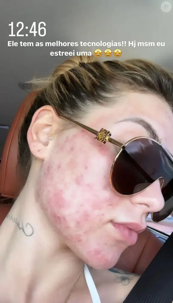 Virgínia Fonseca faz tratamento para a pele (24 de novembro): A influencer foi submetida a um tratamento dermatológico para amenizar os impactos da acne na pele