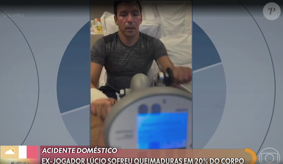 Ex-jogador Lúcio passa por tratamento após grave acidente.
