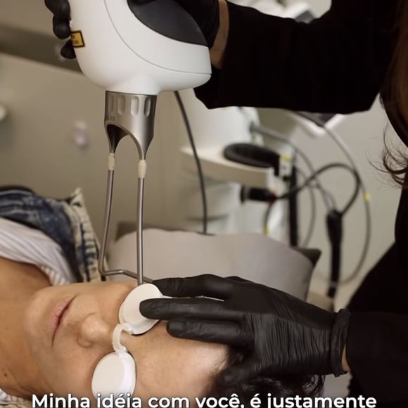 Entre os procedimentos feitos por Helena Rizzo estiveram uma combinação de Sculptra com skinboosters