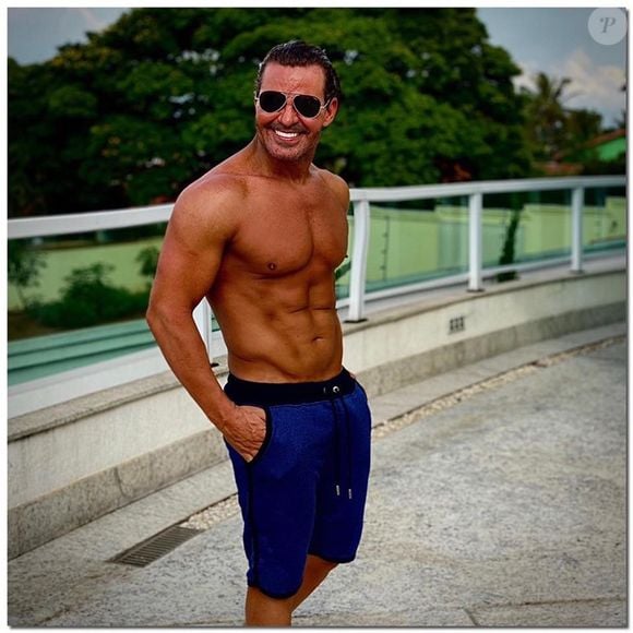 Eduardo Costa diz ter ficado desfigurado devido ao impacto, o que mudou seu rosto