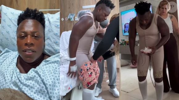 Mamoplastia, lipo escultura e mais: aos 50 anos, Pepê, dupla de Neném, faz transformação radical no corpo em cirurgia de 8 horas