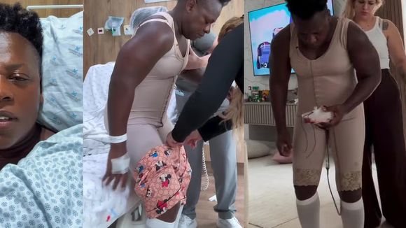 Mamoplastia, lipo escultura e mais: aos 50 anos, Neném, dupla de Pepê, faz transformação radical no corpo em cirurgia de 8 horas