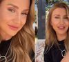 'Minha cara pós-operatório estava uma coisa...': Ana Paula Siebert passa por uma série de mudanças estéticas