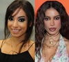 Anitta ouviu que precisava ser bonita para dar certo, percebeu que mudanças estéticas abriam portas e entrou em um 'looping'; segundo Léo Dias, primeiras plásticas custaram R$ 20 mil