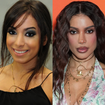 Anitta ouviu que precisava ser bonita para dar certo, percebeu que mudanças estéticas abriam portas e entrou em um 'looping'; segundo Léo Dias, primeiras plásticas custaram R$ 20 mil