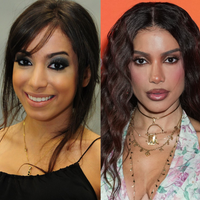 Anitta ouviu que precisava ser bonita para dar certo, percebeu que mudanças estéticas abriam portas e entrou em um 'looping'; segundo Léo Dias, primeiras plásticas custaram R$ 20 mil