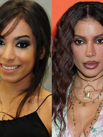 Anitta ouviu que precisava ser bonita para dar certo, percebeu que mudanças estéticas abriam portas e entrou em um 'looping'; segundo Léo Dias, primeiras plásticas custaram R$ 20 mil
