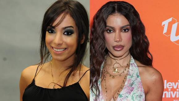 Anitta ouviu que precisava ser bonita para dar certo, percebeu que mudanças estéticas abriam portas e entrou em um 'looping'; segundo Léo Dias, primeiras plásticas custaram R$ 20 mil