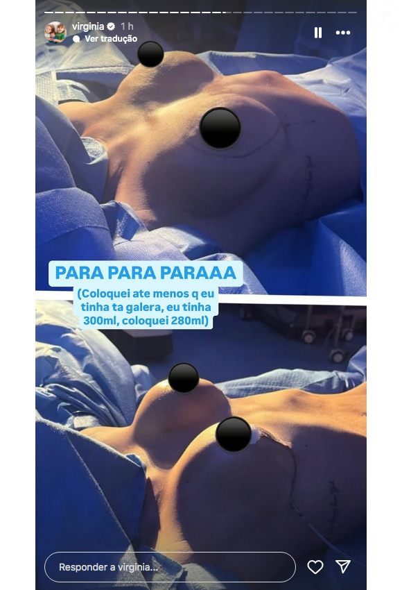 Recentemente,Virgínia Fonseca realizou algumas cirurgias, incluindo uma mastopexia com troca das próteses de silicone