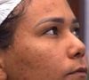 Chaiany Andrade chamou atenção no 'BBB 26' ao exibir sua pele real, levantando debates importantes sobre acne e autoestima.