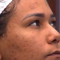 Pele acneica: quais são os cuidados ideais para quem tem, como Chaiany, eliminada do 'BBB 26'? Cosmetóloga faz alerta e revela hábito indispensável na rotina de skincare