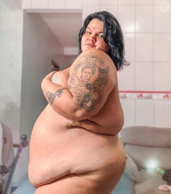Thais Carla estava pesando 170 kg quando fez a bariátrica e já tinha emagrecido muito para a cirurgia