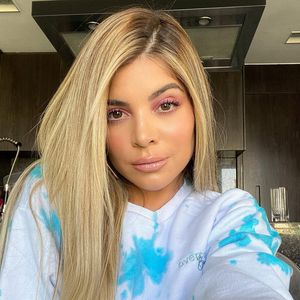 O rosto de Gkay, em meados de 2019 e 2020, já não era tão parecido com anos atrás