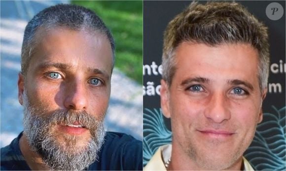 Bruno Gagliasso: outro famoso que mudou o visual com transplante capilar