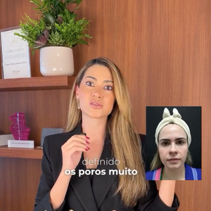 Segundo Bruna Rezende, Ana Paula Renault chegou ao seu consultório com um rosto ovalado e sem contorno definido