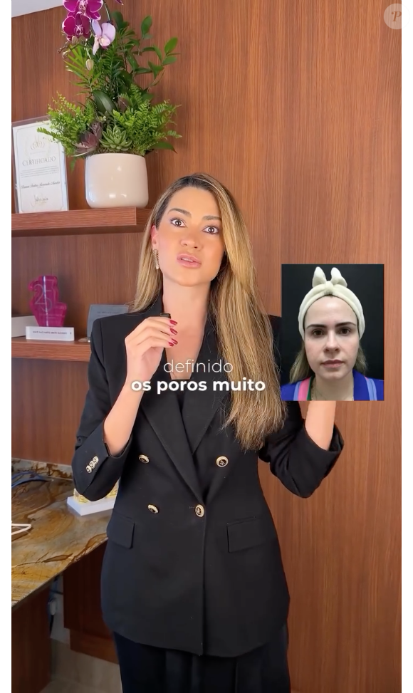 Segundo Bruna Rezende, Ana Paula Renault chegou ao seu consultório com um rosto ovalado e sem contorno definido