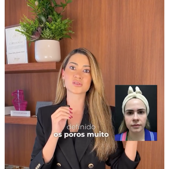 Segundo Bruna Rezende, Ana Paula Renault chegou ao seu consultório com um rosto ovalado e sem contorno definido