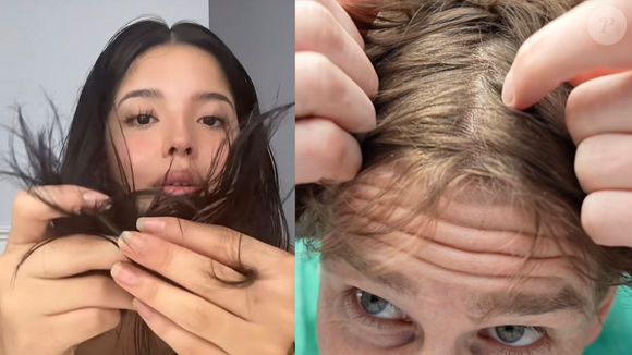 Enquanto um couro cabeludo oleoso pode precisar de uma limpeza mais eficaz para remover o excesso de sebo, em um couro cabeludo seco convém apostar em fórmulas mais suaves