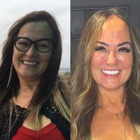 Antes e depois de Nadine Gonçalves: mãe de Neymar rejuvenesceu com procedimentos estéticos e 28 fotos destacam mudança impactante