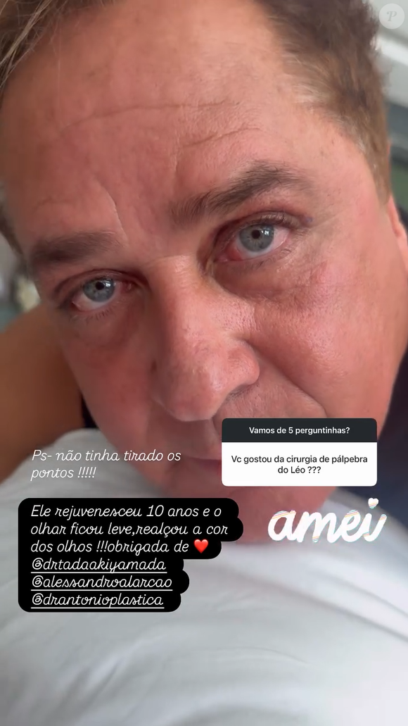 Resultado da blefaroplastia de Leonardo foi elogiada por Poliana Rocha: ‘Ele rejuvenesceu dez anos’