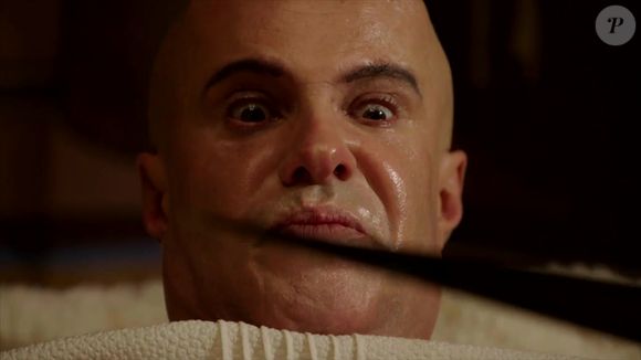 Últimos capítulos de 'Gênesis': Dessa forma, Shetep (Camilo Belivacqua) não terminou a cirurgia em Menkhe (Renato Rabelo)