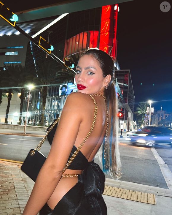 Catherine Bascoy também realizou um preenchimento labial para dar mais volume na região