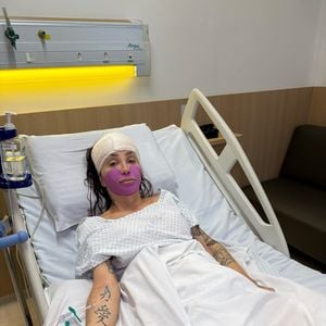 Maya Massafera passou por um procedimento estético recentemente para retirar parte do maxilar e deixar o rosto mais fino