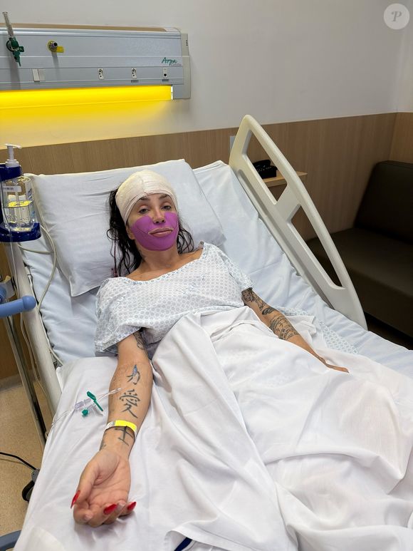 Maya Massafera passou por um procedimento estético recentemente para retirar parte do maxilar e deixar o rosto mais fino