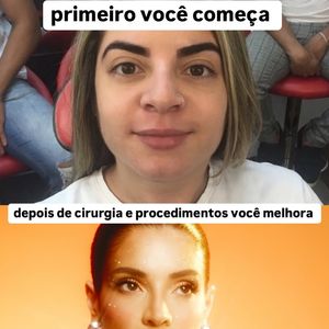 Veja o antes e depois de Gkay com uma foto antiga e a mais recente da influenciadora!