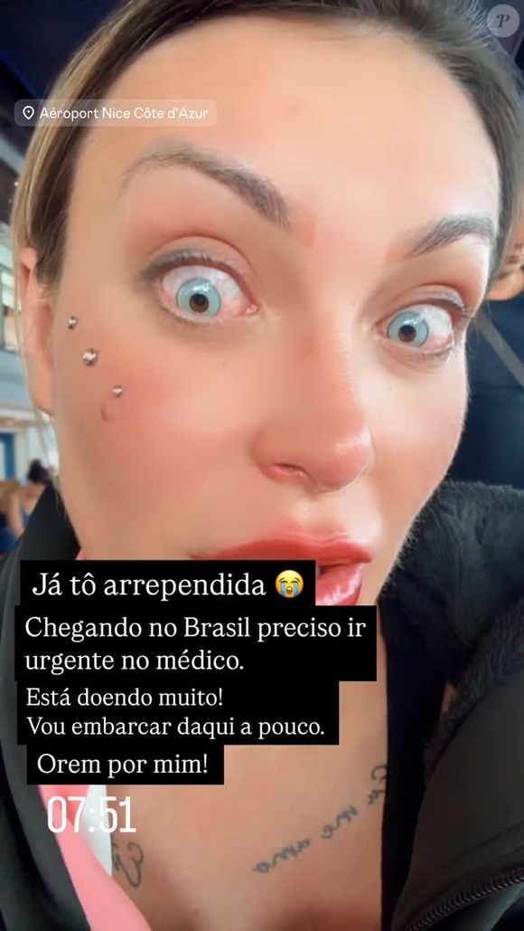 Andressa Urach passou por um procedimento oftalmológico que consiste na aplicação de pigmento na córnea, o que altera a cor dos olhos