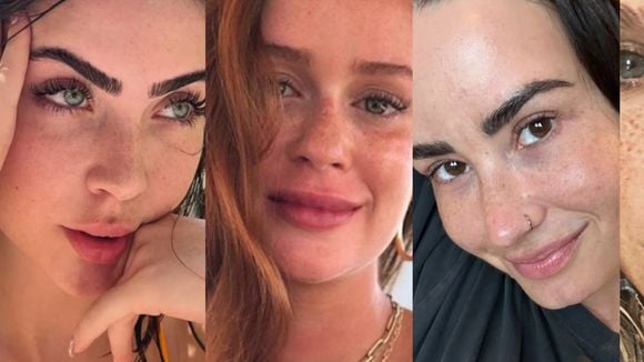 20 famosas com sardinhas naturais que vão fazer você amar as suas neste inverno
