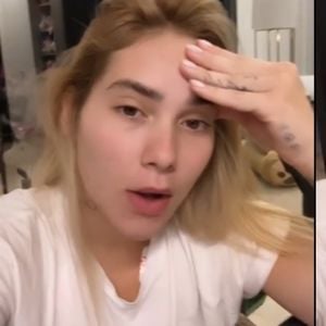 Assim como o cacau, diagnósticos de enxaqueca também exigem alerta a outros alimentos, como o gengibre e a cúrcuma