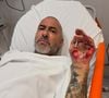 Henrique Fogaça contou que quebrou três costelas, machucou a bacia, o tornozelo, os joelhos e as mãos após cair de moto na Rodovia Castelo Branco durante o retorno das gravações do 'MasterChef Brasil'