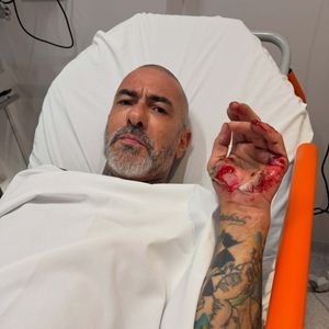 Henrique Fogaça contou que quebrou três costelas, machucou a bacia, o tornozelo, os joelhos e as mãos após cair de moto na Rodovia Castelo Branco durante o retorno das gravações do 'MasterChef Brasil'