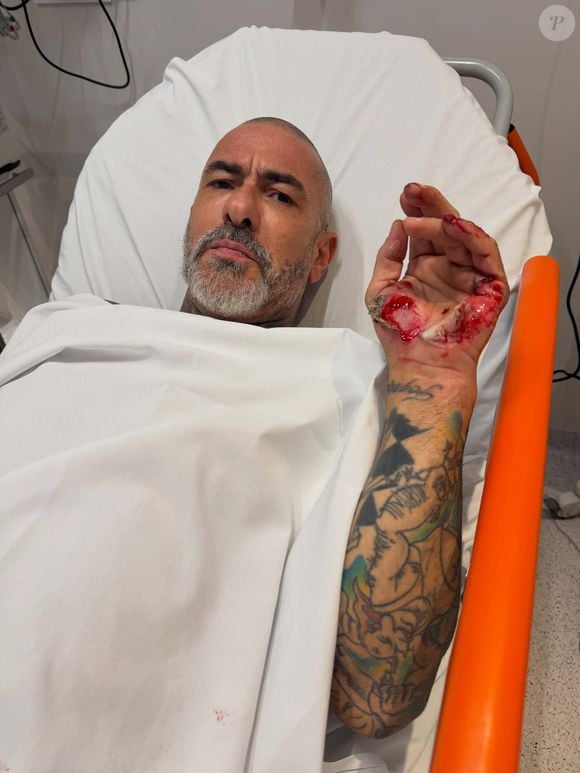 Henrique Fogaça contou que quebrou três costelas, machucou a bacia, o tornozelo, os joelhos e as mãos após cair de moto na Rodovia Castelo Branco durante o retorno das gravações do 'MasterChef Brasil'