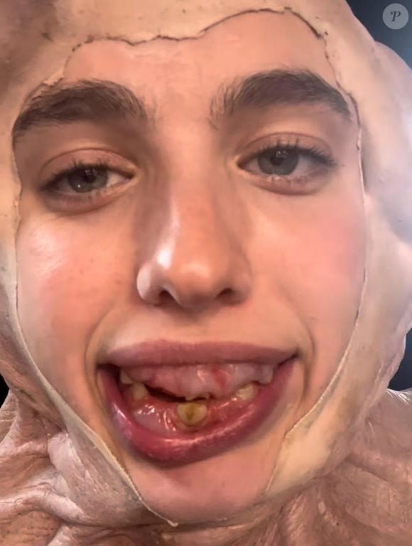 As próteses também foram usadas para o monstro do final de 'A Substância', e causaram uma crise de acne na atriz