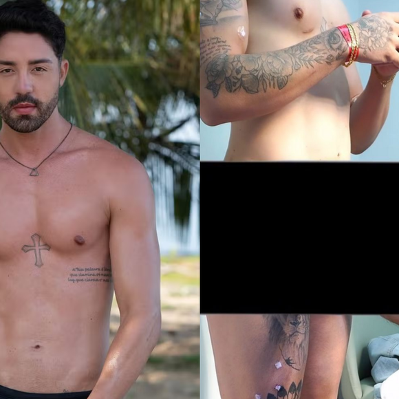 Gente... Rico Melquíades mostra o resultado de sua harmonização íntima para a avó e idosa reprova: ‘Desgraça’