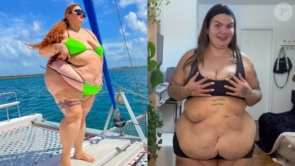 Veja o antes e depois de Thais Carla 6 meses após a cirurgia bariátrica